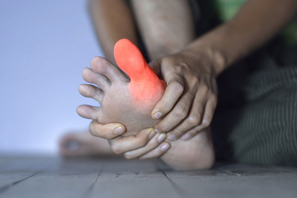 person's foot image for Arthritis condition